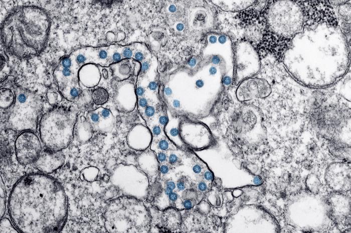 IATA: coronavirus kost luchtvaart 63 tot 113 miljard dollar